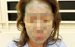 Người phụ nữ nguy kịch sau khi dùng thuốc giảm cân thải độc, collagen không rõ nguồn gốc