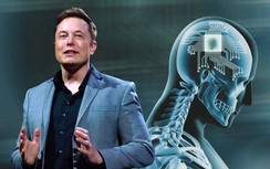 Tác dụng thần kỳ từ chip não của tỷ phú Elon Musk 