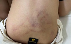 Hà Nội: Tạm đình chỉ giáo viên trường Mầm non Gia Thụy nghi bạo hành trẻ