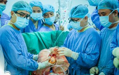 Kỳ tích ghép thành công đồng thời tim - phổi cho người bệnh suy đa tạng