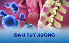 Thêm cơ hội kéo dài cuộc sống cho các bệnh nhân đa u tủy xương