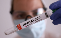 WHO cảnh báo có thể xuất hiện thêm ca mắc hantavirus