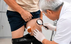 Sau tắm suối nam trung niên nhiễm ấu trùng sán nhái hiếm gặp
