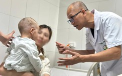 Phục hồi khuôn mặt cho bé trai 26 tháng tuổi bị chó nhà cắn nát vùng hàm mặt