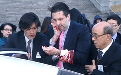 Triều Tiên nói gì về vụ Đại sứ Mỹ bị tấn công?