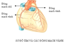 Hẹp động mạch vành không nhất thiết phải đặt stent