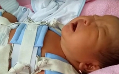 Bộ Y tế vào cuộc vụ “làm gãy xương đùi trẻ sơ sinh”