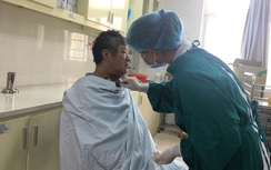 Biến chứng nguy hiểm vì không nhổ “răng khôn”