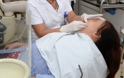 Cảnh báo biến chứng nguy hiểm khi bọc răng sứ