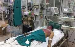 Nam thanh niên nguy kịch vì tự điều trị thủy đậu
