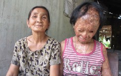 Tử tù hiến tạng, bà xin giác mạc cho cháu mù lòa được không?