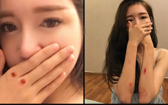 Fan xót xa khi Elly Trần bầm dập vì phim hành động