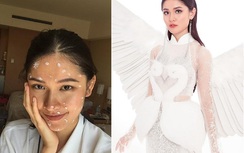Bị thủy đậu, Thùy Dung vẫn lọt top 3 nhan sắc Miss International 2017