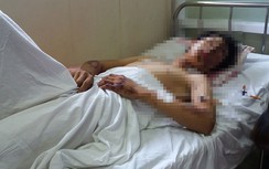 Thực hư thanh niên “đầu trần” trọng thương nghi CSGT truy đuổi?