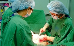 Nguyên nhân kim khâu "thất lạc" trong vùng kín sản phụ