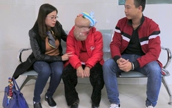 Người phụ nữ "mặt quỷ” được tài trợ toàn bộ chi phí điều trị