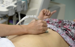 Thoát án tử nhờ sàng lọc ung thư sớm