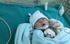 Phẫu thuật tim cho trẻ mới 6 ngày tuổi, nặng 1,5kg