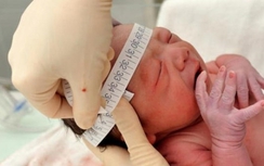 Phát hiện thêm trường hợp trẻ mắc chứng đầu nhỏ