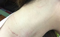 Nhân viên bị khách hành hung: Vietnam Airlines nói gì?