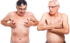 Báo động: Ung thư vú ở nam giới đang gia tăng