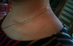 "Nghịch tử" táo tợn giật dây chuyền của mẹ già 85 tuổi