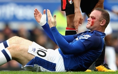 Cựu đội trưởng M.U chảy máu đầm đìa sau khi “ăn đòn” trên sân