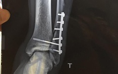 Sao U20 Việt Nam có nguy cơ giải nghệ sớm