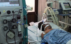 Bệnh viêm não mô cầu nguy hiểm như thế nào?