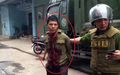 Vụ chém lìa tay chị gái: Người anh rể đã tử vong