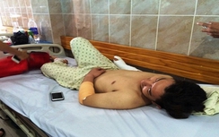 Chủ quán cà phê bị chém lìa ngón tay ở Sài Gòn