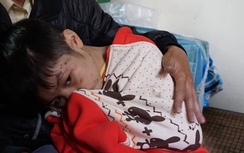 Chủ tịch HN yêu cầu xử nghiêm vụ bạo hành bé trai 10 tuổi