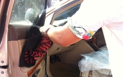 Đại gia Hải Phòng và bạn gái bị tạt axit: Nguy cơ mù mắt