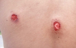 Tin mới vụ Trưởng công an xã bắn dân 2 phát