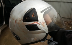 Nhà báo Đỗ Doãn Hoàng bị 3 côn đồ hành hung