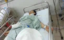 CSCĐ bắn trọng thương kẻ chĩa súng uy hiếp