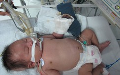 Tiêm phòng lao, bé sơ sinh hoại tử tay rồi tử vong