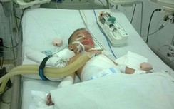 'Cứu' trẻ đuối nước bằng cách bỏ vào lu rồi hơ trên lửa