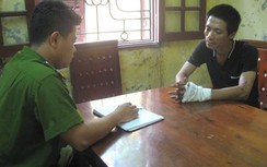 Bắt giam kẻ hắt axít vào vợ vì ghen