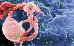 Chưa thể lý giải vì sao tái nhiễm HIV