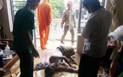 Một thợ hàn xì bất cẩn bị cháy xém do điện giật