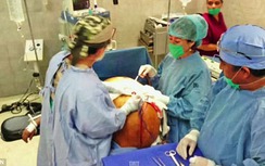 Khối u buồng trứng "lập kỷ lục" 60kg