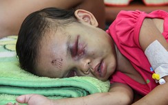 Lời khai man rợ của cặp vợ chồng hành hạ con gái 4 tuổi