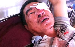 Quốc lộ 14: Xe khách liên tục bị ném đá