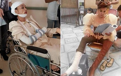 Xót xa hình ảnh sao Việt "bầm dập" vì nghệ thuật