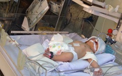 Gần 200 triệu hỗ trợ bé sơ sinh sống sót sau vụ xe đâm
