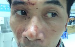 Tổ trưởng tổ bảo vệ dân phố đánh dân chảy máu?