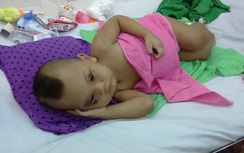 Bé trai 2 tuổi bị bà ngoại bạo hành đã qua cơn nguy kịch