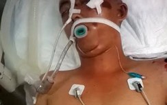 Tìm thân nhân nam thanh niên đi nhờ xe bị TNGT bất tỉnh