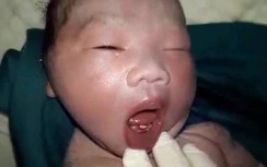 Hà Tĩnh: Lạ lùng bé trai mọc răng từ trong bụng mẹ